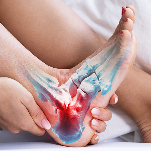 Arthroscopic Surgery / Repair
