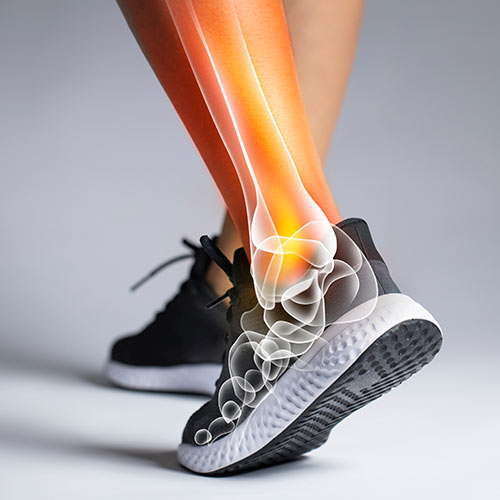 Tendon Repair