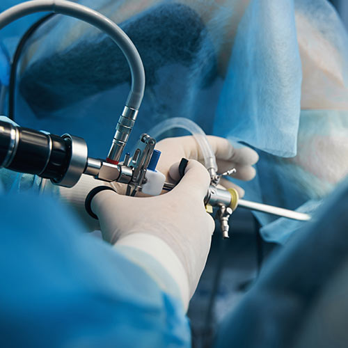 Hysteroscopy / Uterine Ablation